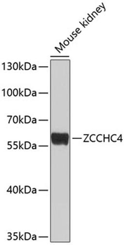 Western blot - ZCCHC4 antibody (A10144)