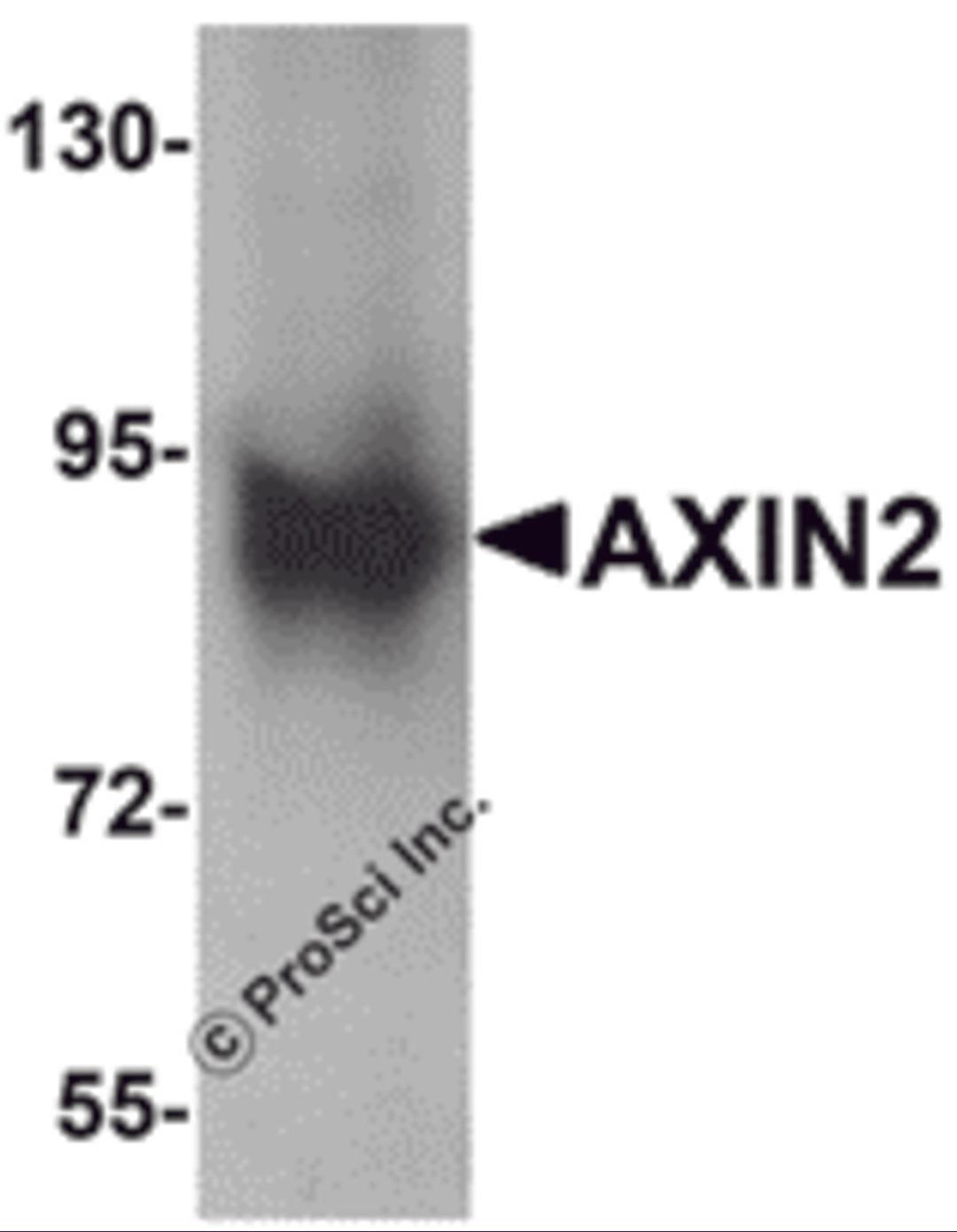 Western blot analysis of AXIN2 in mouse lung lysate with AXIN2 antibody at 1 μg/mL.