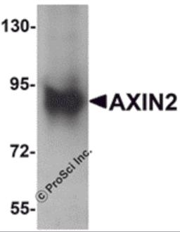 Western blot analysis of AXIN2 in mouse lung lysate with AXIN2 antibody at 1 μg/mL.