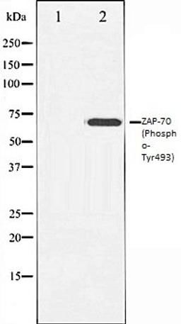 Western blot analysis of Jurkat whole cell lysates using ZAP-70 (Phospho-Tyr493) antibody, The lane on the left is treated with the antigen-specific peptide.