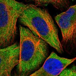 Immunocytochemistry/Immunofluorescence: CLPB Antibody [NBP1-83703] - Staining of human cell line U-2 OS shows positivity in cytoplasm.