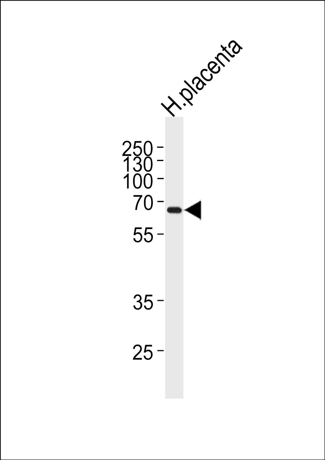 Western blot analysis of lysate from human placenta tissue lysate, using MMP19 Antibody at 1:1000 at each lane.