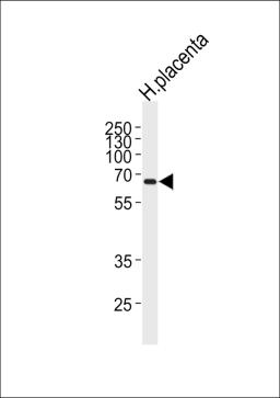 Western blot analysis of lysate from human placenta tissue lysate, using MMP19 Antibody at 1:1000 at each lane.