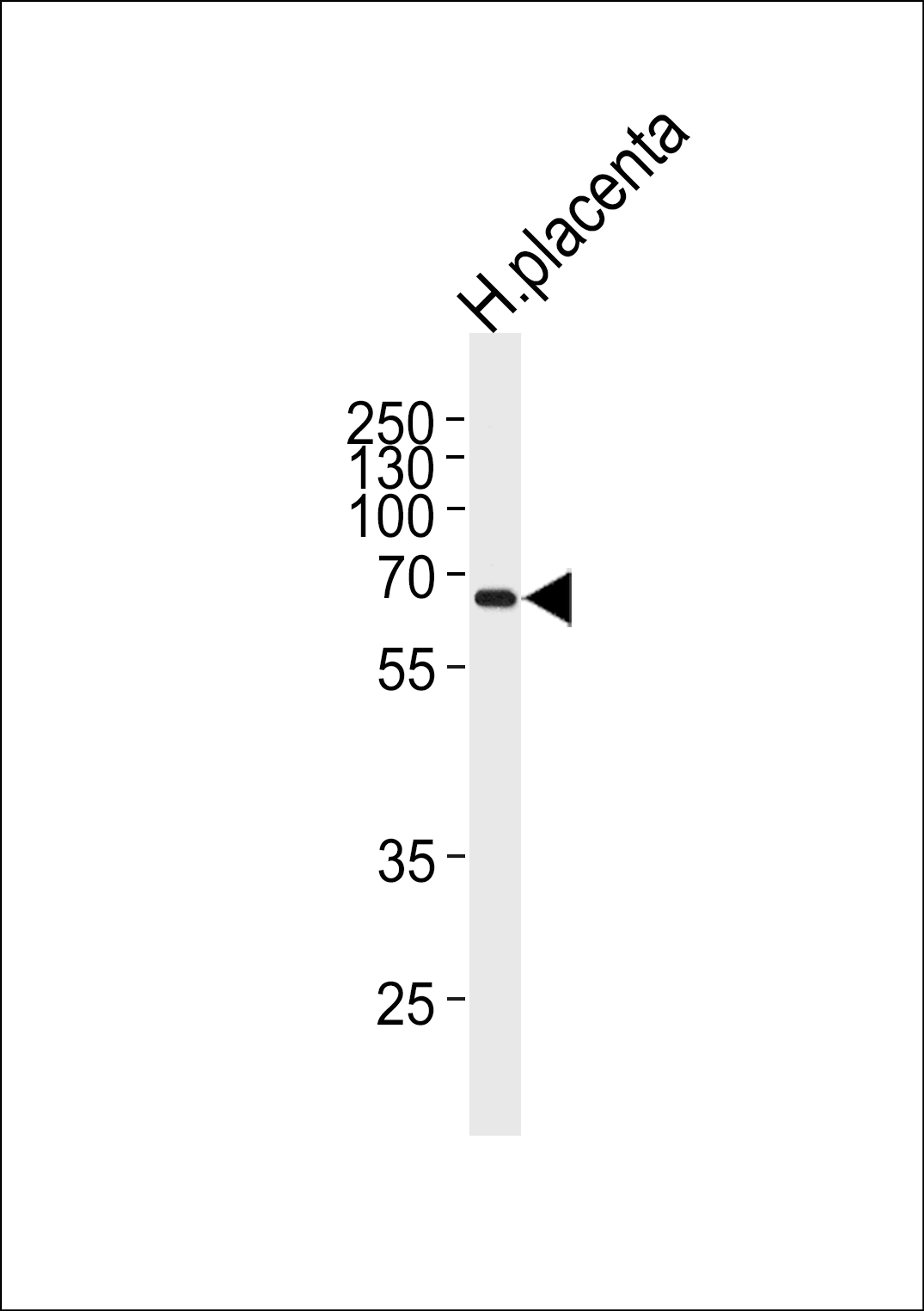 Western blot analysis of lysate from human placenta tissue lysate, using MMP19 Antibody at 1:1000 at each lane.