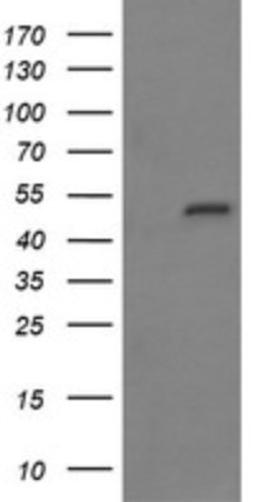 Western Blot: MYBPH Antibody (3G1) [NBP2-45839] - Analysis of HEK293T cells were transfected with the pCMV6-ENTRY control (Left lane) or pCMV6-ENTRY MYBPH.