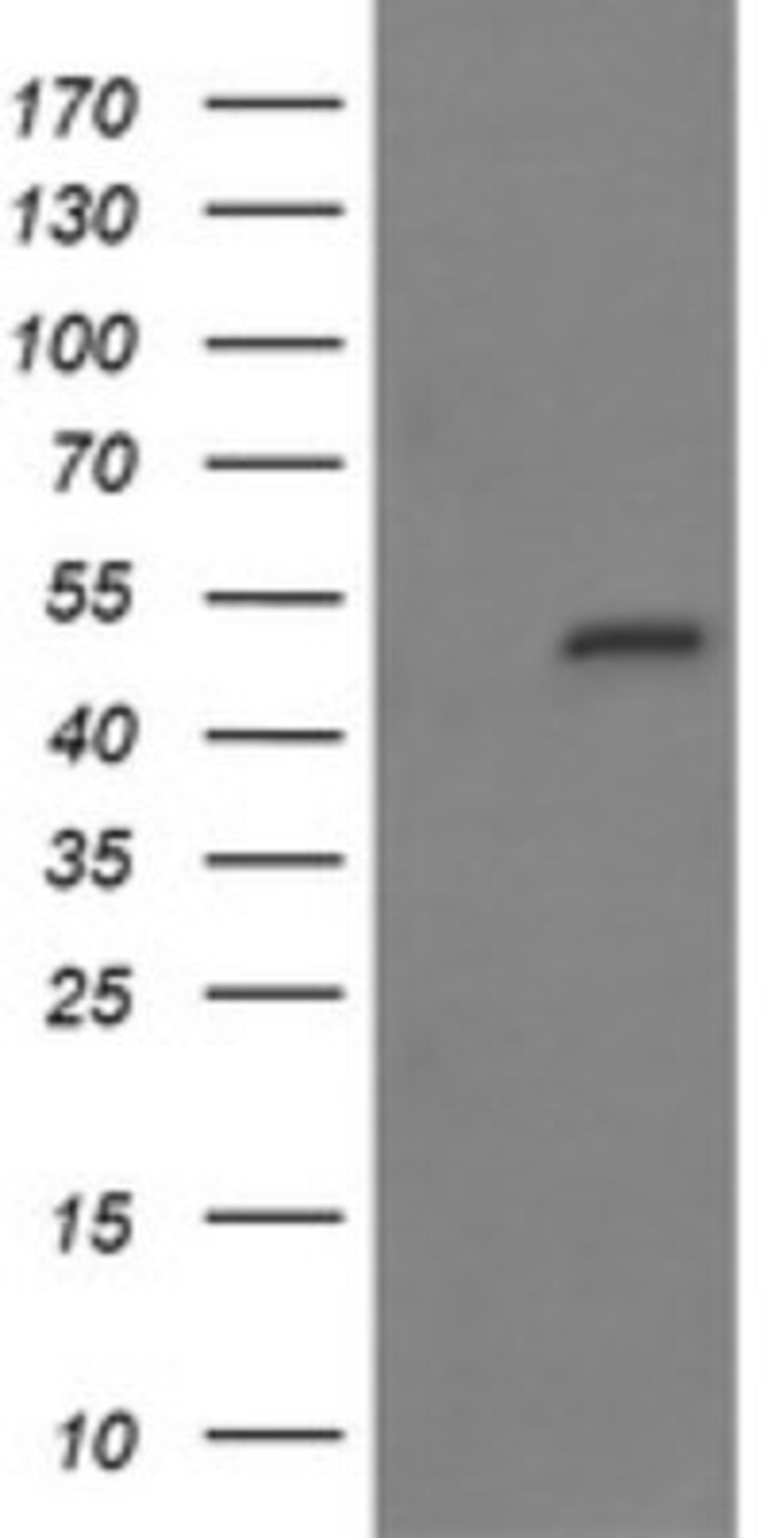 Western Blot: MYBPH Antibody (3G1) [NBP2-45839] - Analysis of HEK293T cells were transfected with the pCMV6-ENTRY control (Left lane) or pCMV6-ENTRY MYBPH.