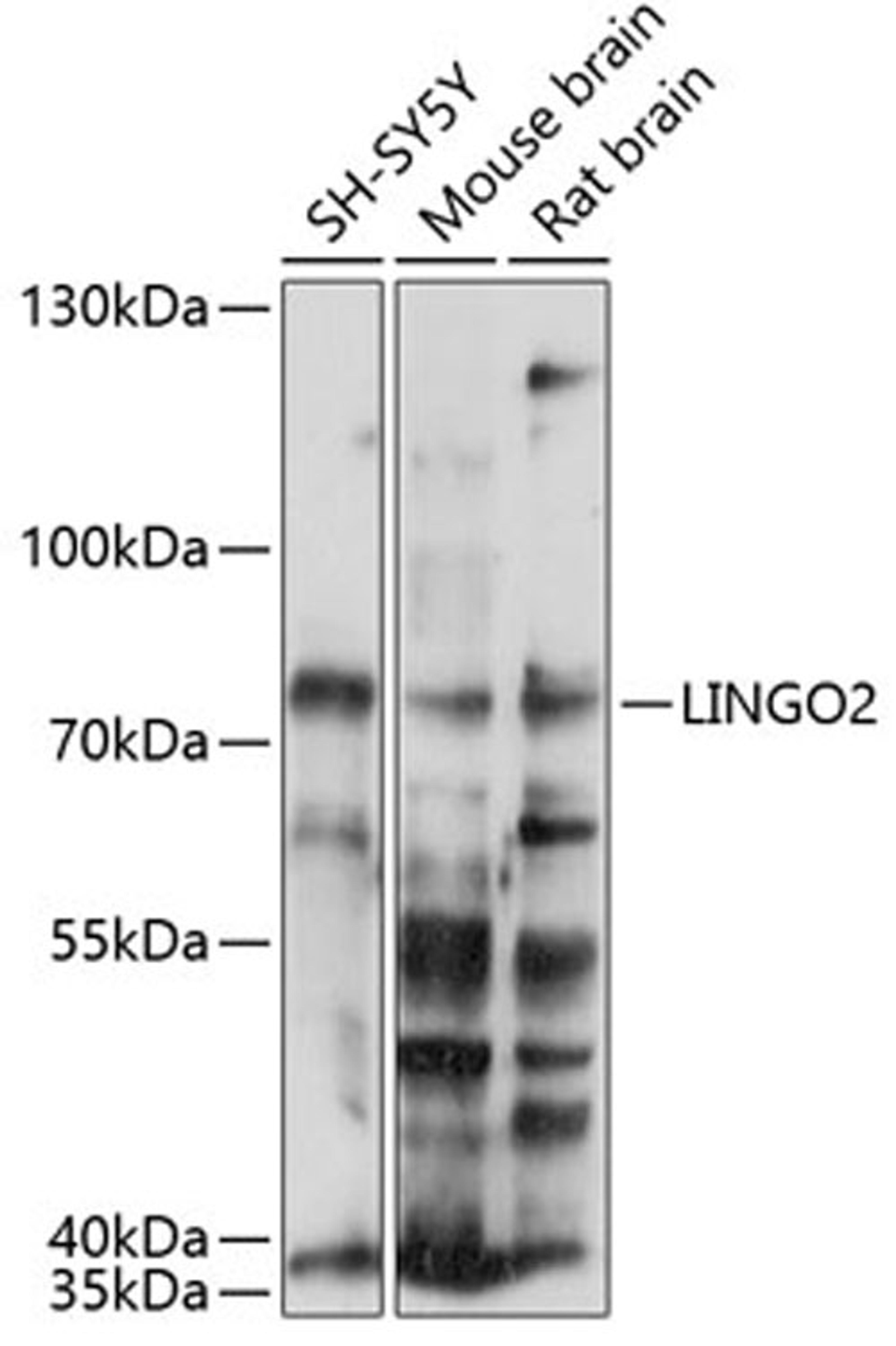 Western blot - LINGO2 antibody (A14968)