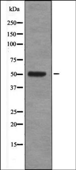 Western blot analysis of Insulin treated HeLa whole cell lysates using Fos -Phospho-Ser374- antibody