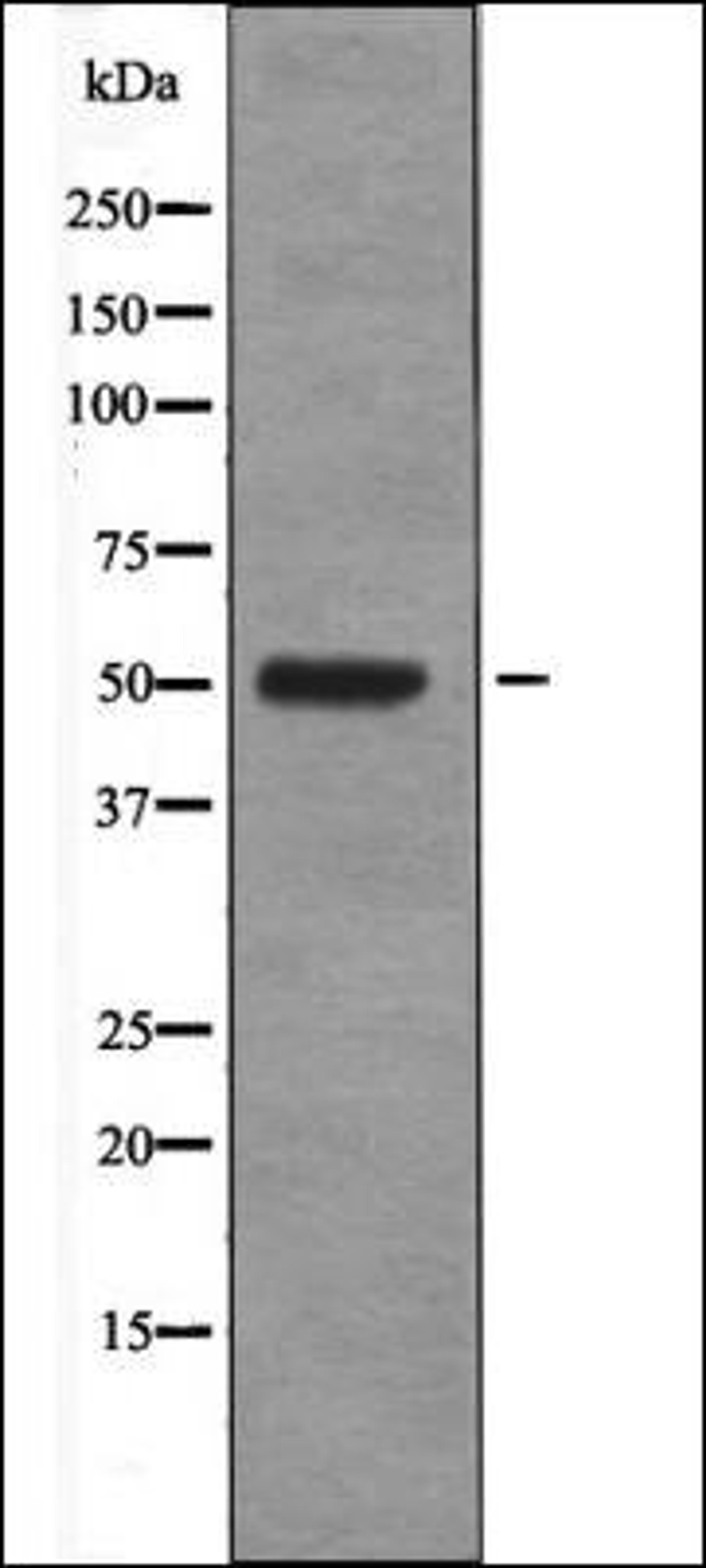 Western blot analysis of Insulin treated HeLa whole cell lysates using Fos -Phospho-Ser374- antibody