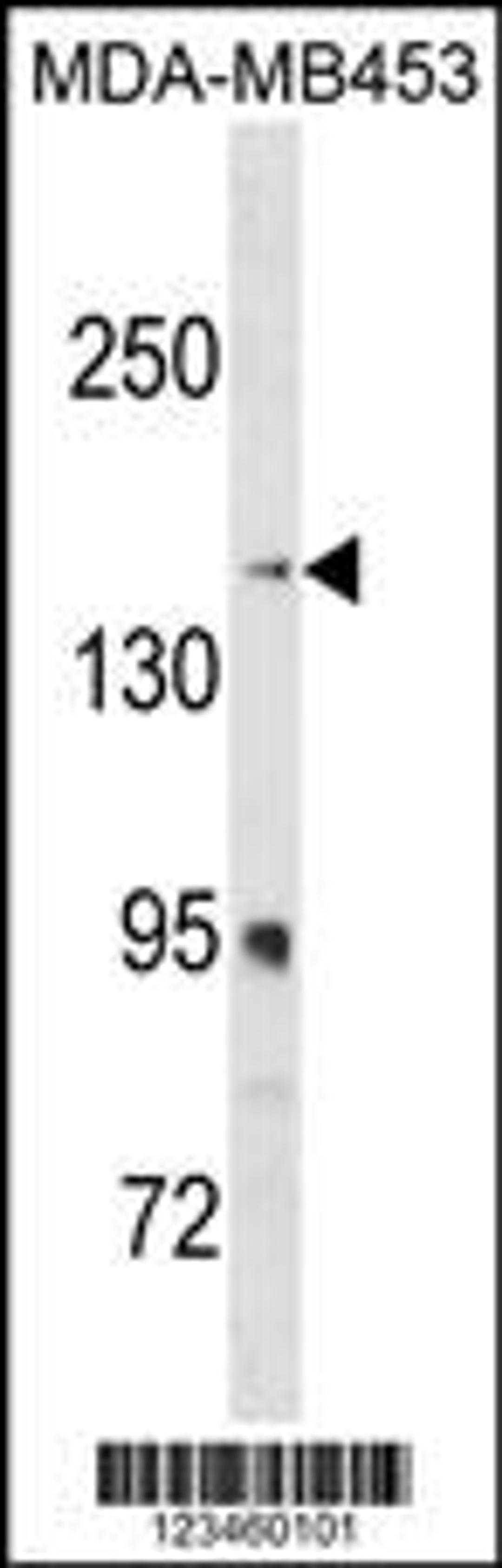 Western blot analysis in MDA-MB453 cell line lysates (35ug/lane).