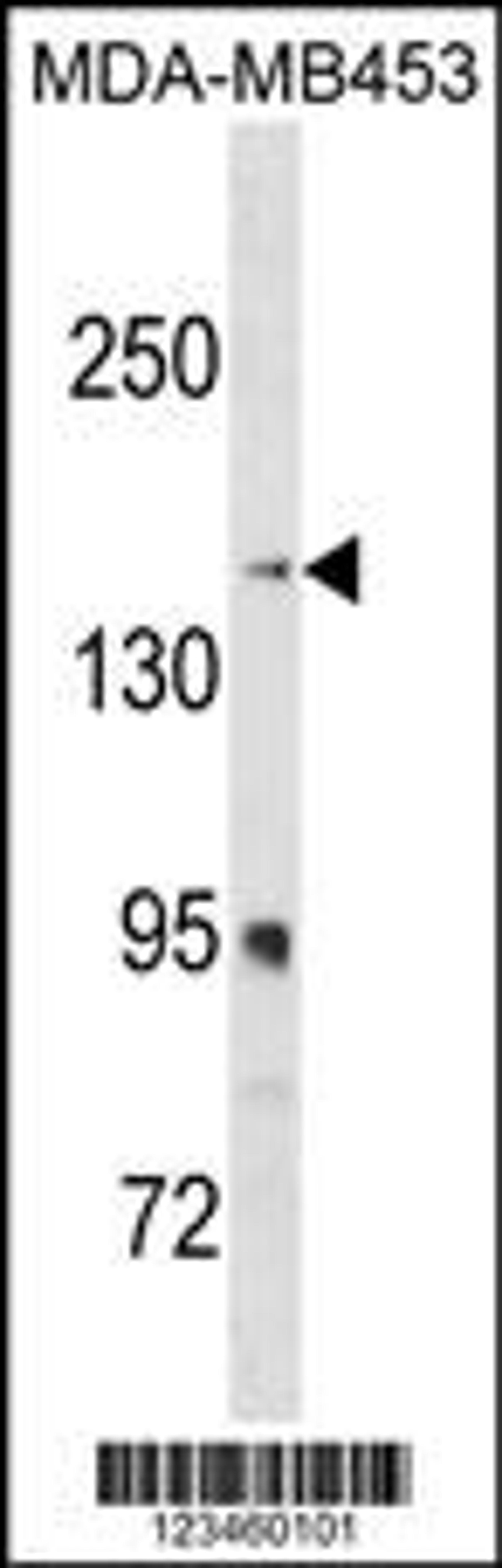 Western blot analysis in MDA-MB453 cell line lysates (35ug/lane).