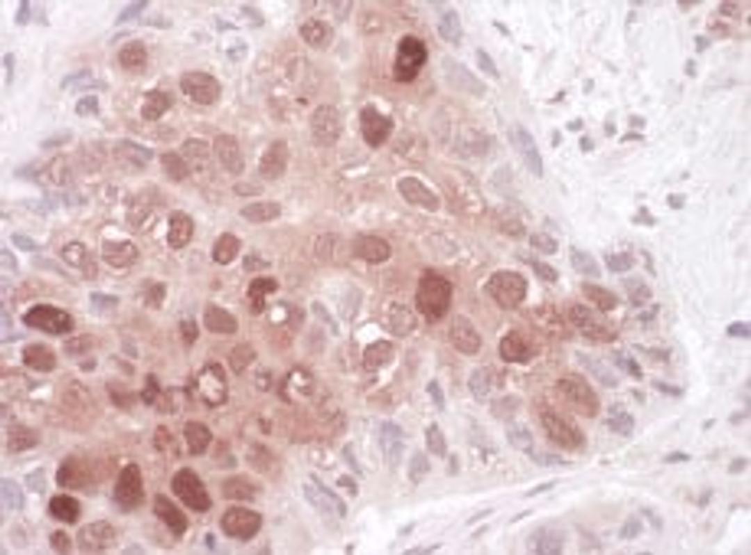 Detection of human Sequestosome-1 by immunohistochemistry.