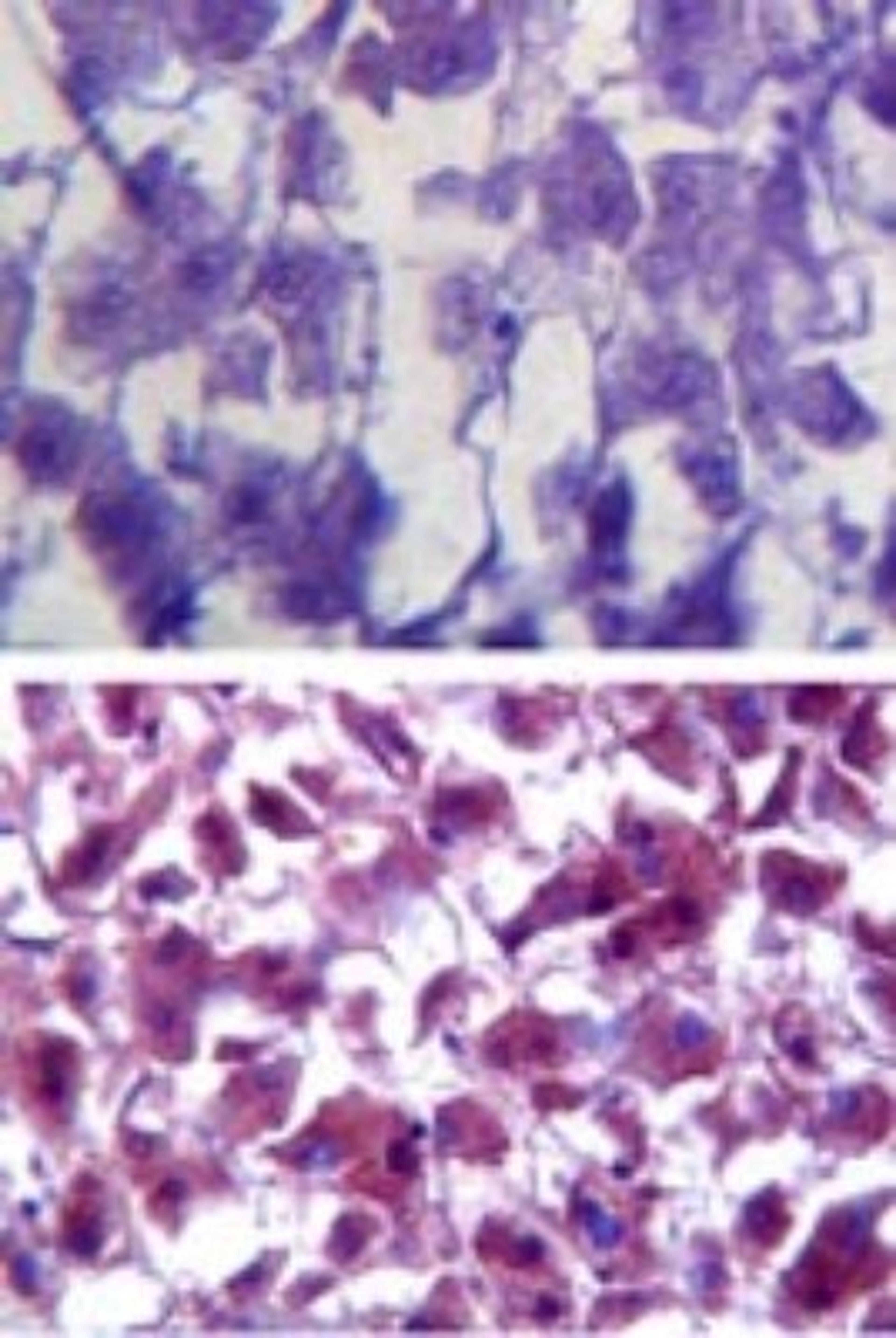 Immunohistochemistry-Paraffin: Superoxide Dismutase 1 Antibody [NBP2-24915] - Analysis of Superoxide Dismutase 1 in paraffin-embedded formalin-fixed human liver tissue using an isotype control (top) and NBP2-24915 (bottom) at 5 ug/ml.