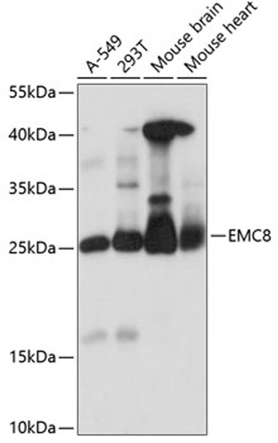 Western blot - EMC8 antibody (A14838)