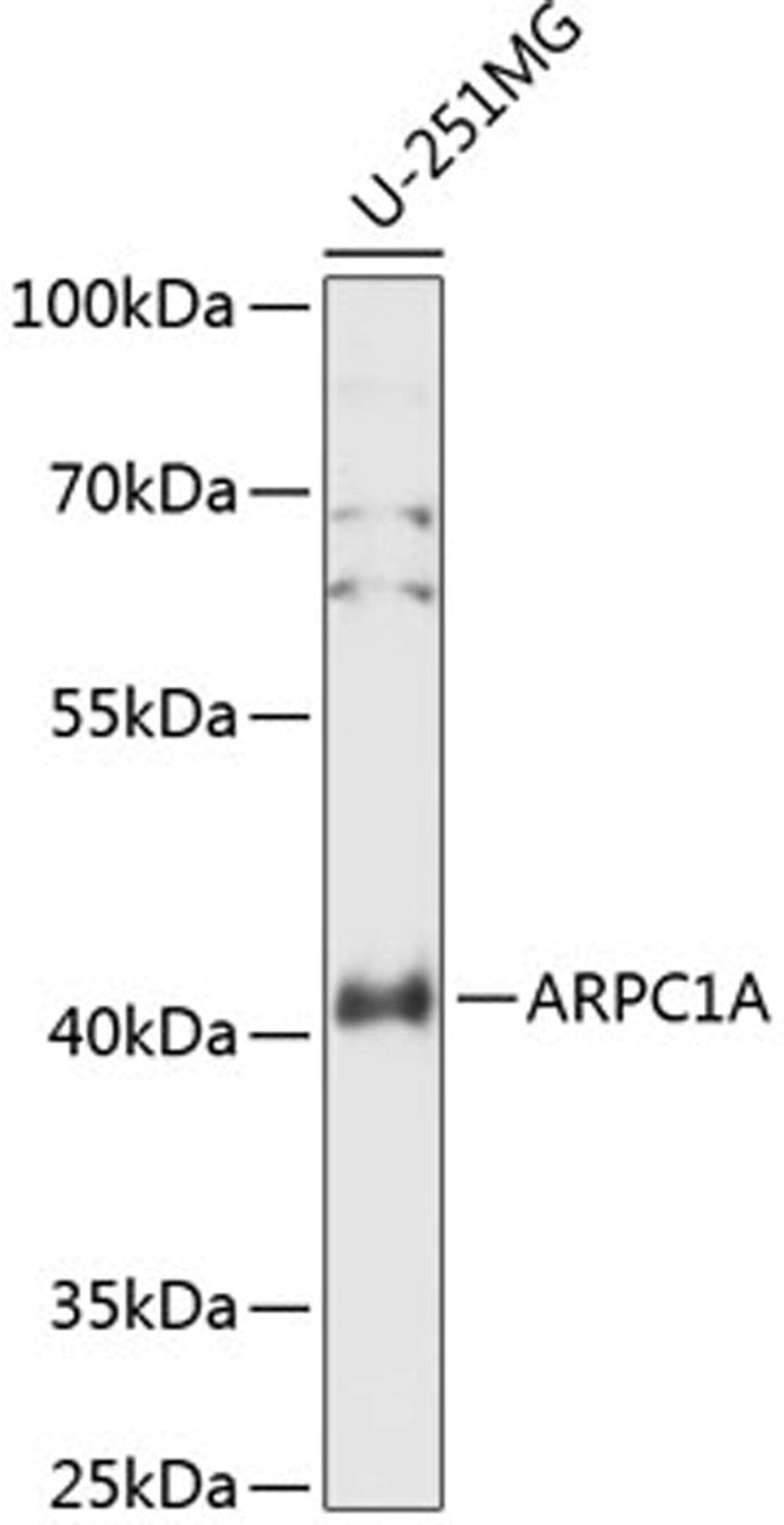 Western blot - ARPC1A antibody (A14502)