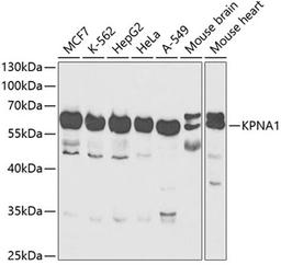 Western blot - KPNA1 antibody (A13623)