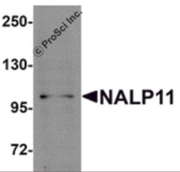 Western blot analysis of NALP11 in HeLa cell lysate with NALP11 antibody at 1 μg/mL.