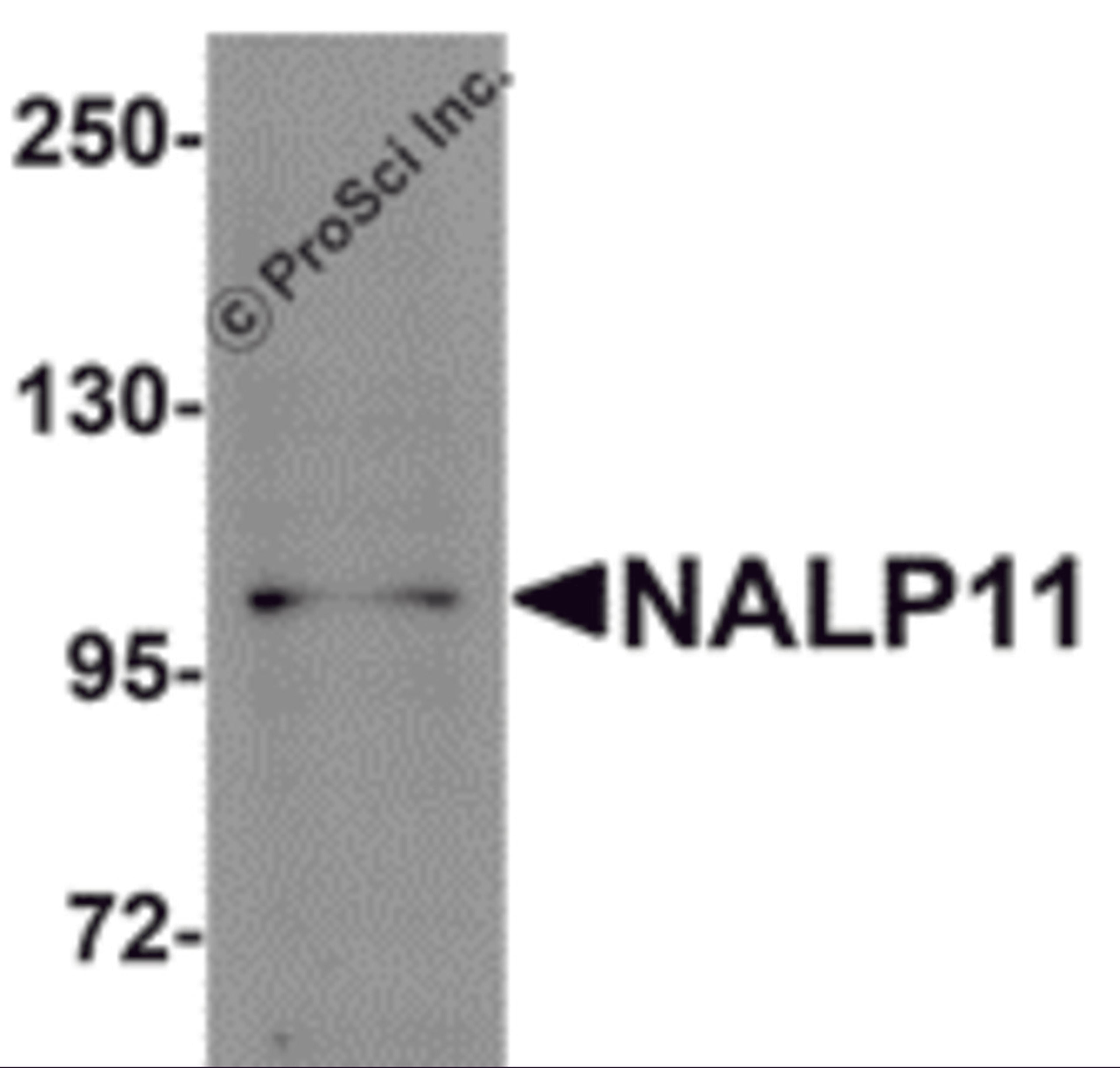 Western blot analysis of NALP11 in HeLa cell lysate with NALP11 antibody at 1 μg/mL.