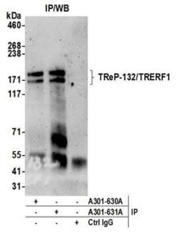 Detection of human TReP-132/TRERF1 by western blot of immunoprecipitates.