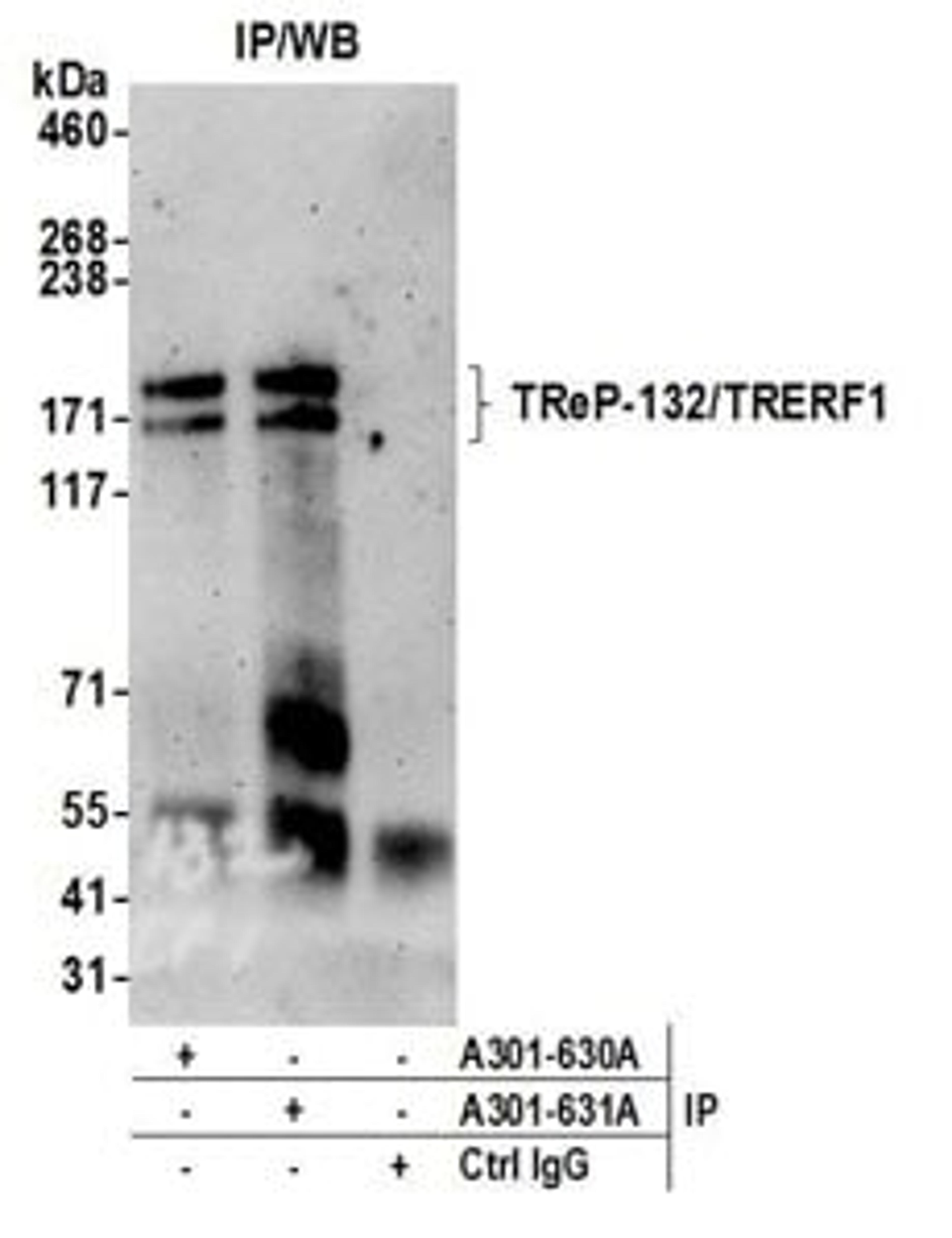 Detection of human TReP-132/TRERF1 by western blot of immunoprecipitates.