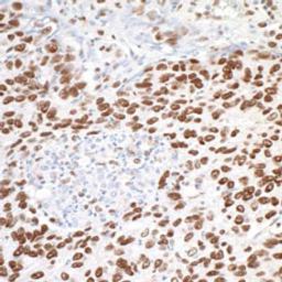 Detection of human MTA1 by immunohistochemistry.