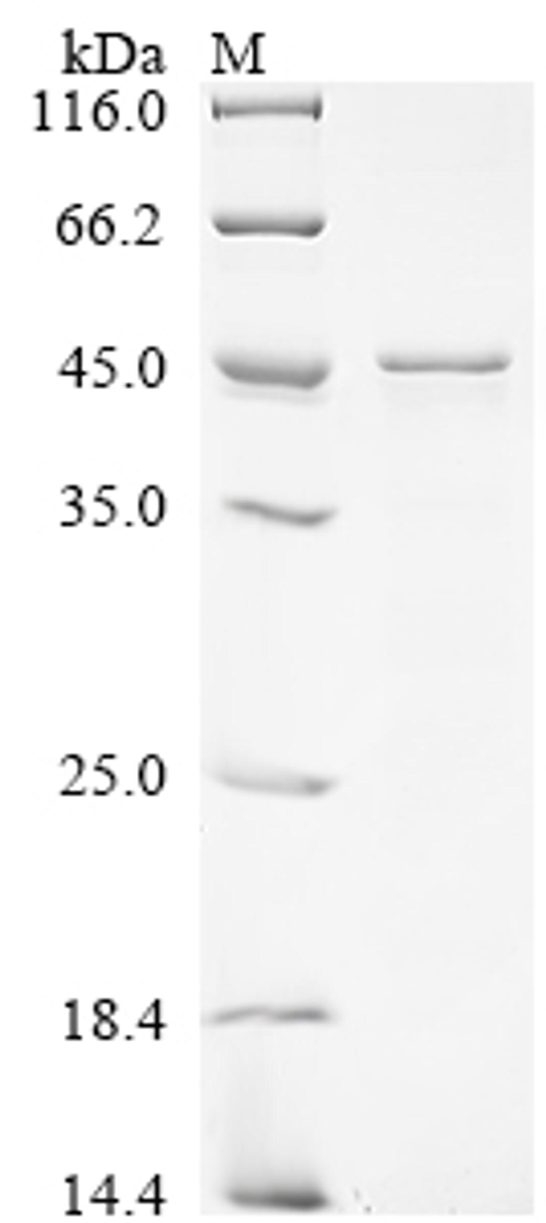 (Tris-Glycine gel) Discontinuous SDS-PAGE (reduced) with 5% enrichment gel and 15% separation gel.