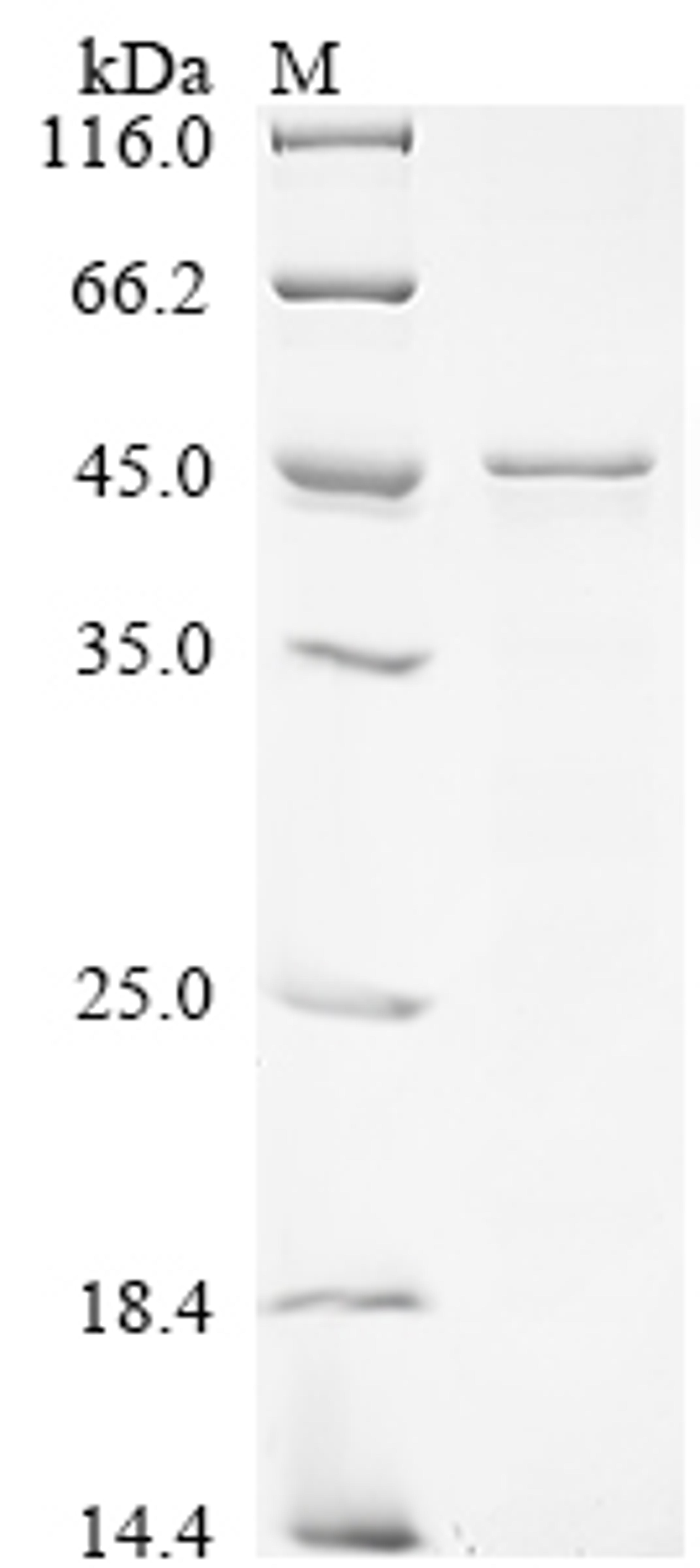 (Tris-Glycine gel) Discontinuous SDS-PAGE (reduced) with 5% enrichment gel and 15% separation gel.