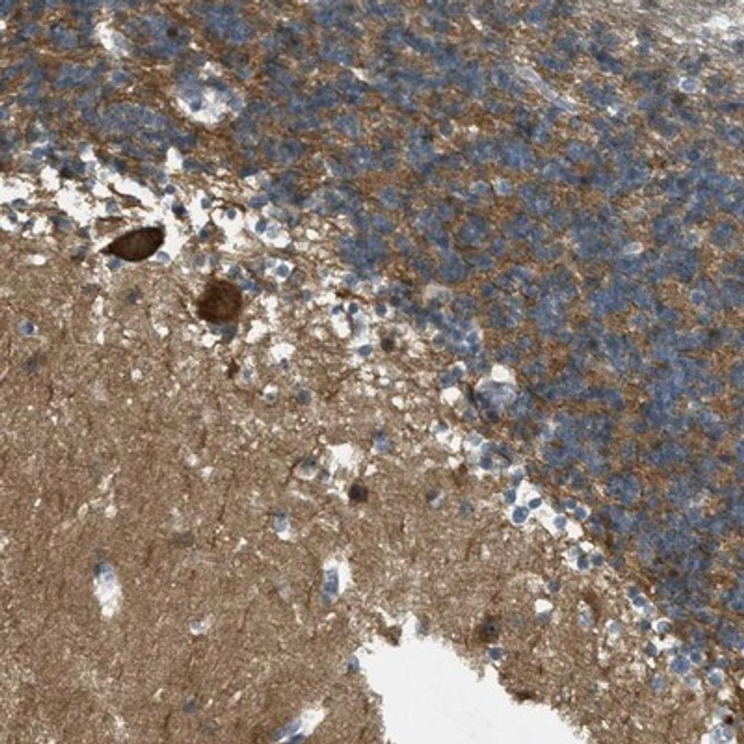 Immunohistochemistry-Paraffin: OSMR Antibody [NBP1-82471] - Immunohistochemical staining of human cerebellum shows strong positivity in Purkinje cells.