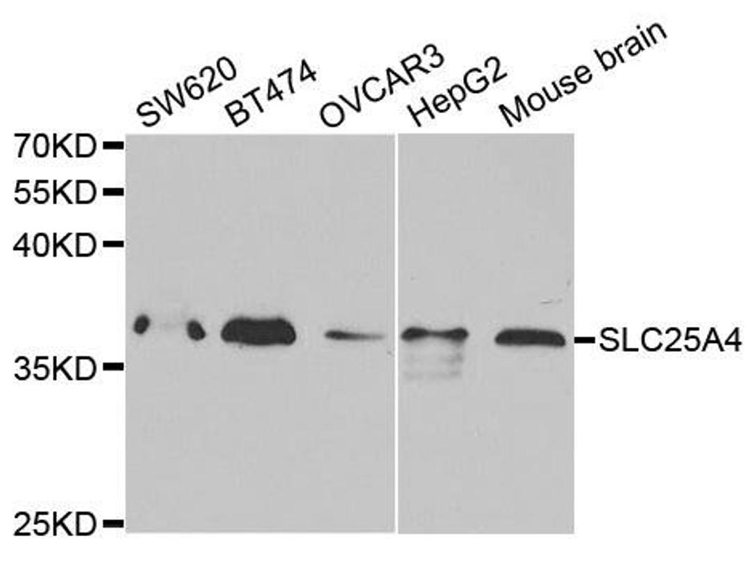 Western blot analysis of extracts of various cell lines using SLC25A4 antibody