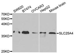 Western blot analysis of extracts of various cell lines using SLC25A4 antibody