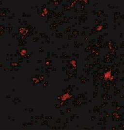 Immunocytochemistry/Immunofluorescence: BAIAP3 Antibody [NBP2-41079] - Immunofluorescence of BAP3 in human brain tissue with BAP3 antibody at 20 ug/mL.