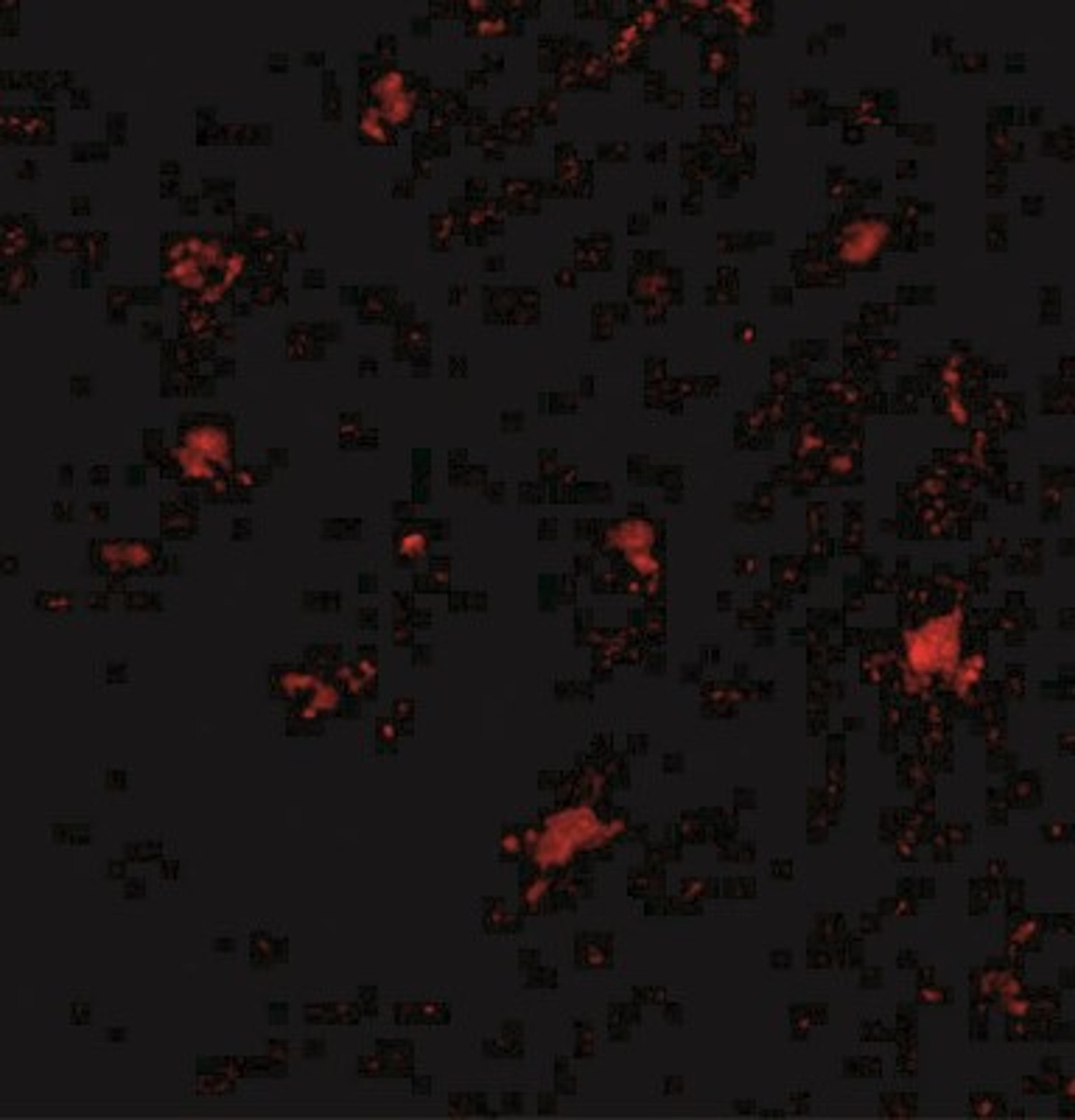 Immunocytochemistry/Immunofluorescence: BAIAP3 Antibody [NBP2-41079] - Immunofluorescence of BAP3 in human brain tissue with BAP3 antibody at 20 ug/mL.