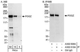 Detection of human POGZ by western blot and immunoprecipitation.