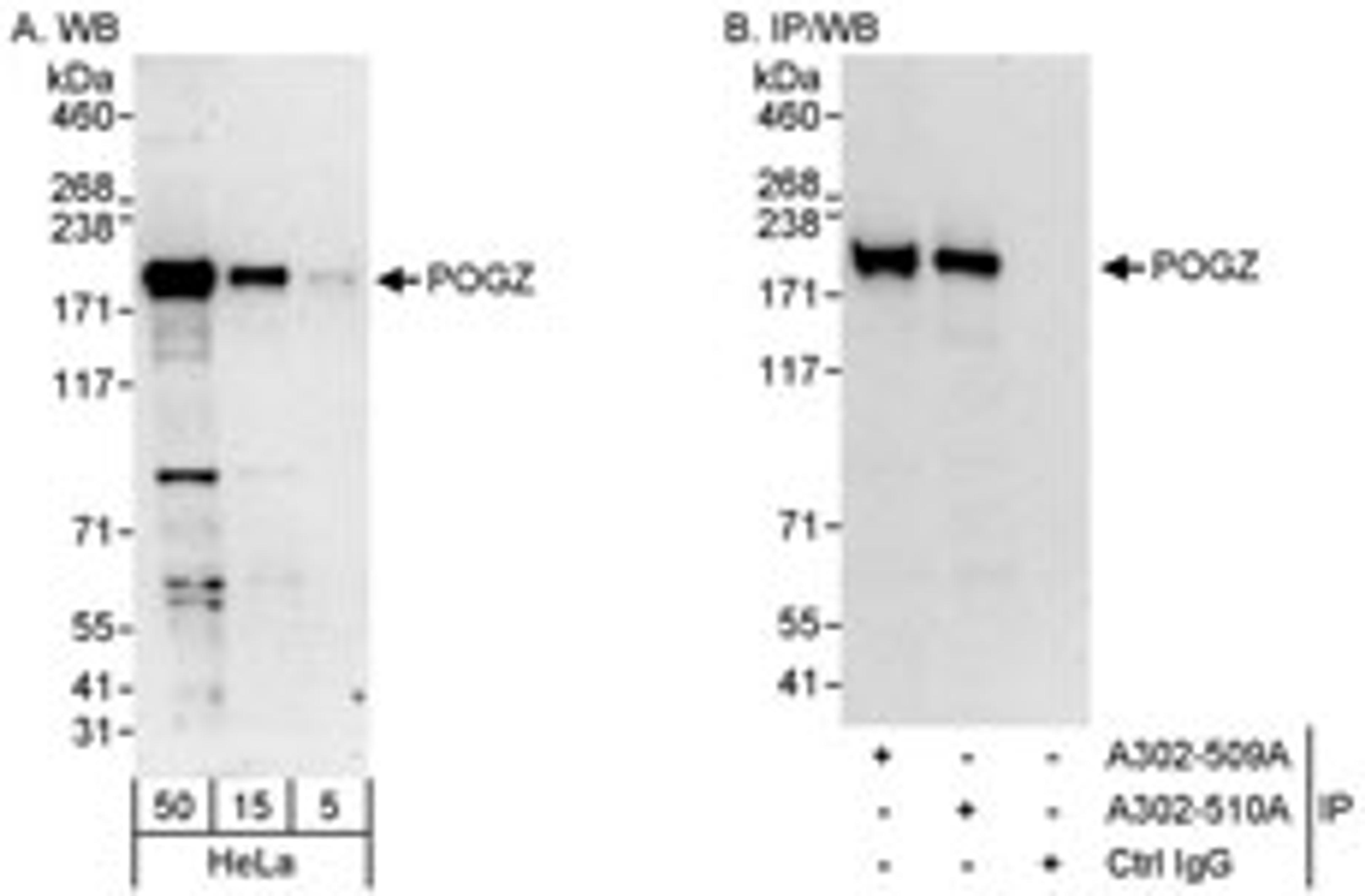 Detection of human POGZ by western blot and immunoprecipitation.