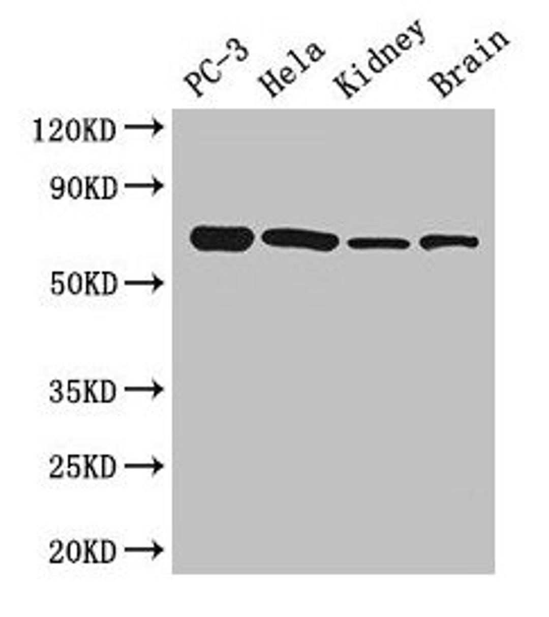 Western Blot. Positive WB detected in: PC-3 whole cell lysate, Hela whole cell lysate, Mouse kidney tissue, Mouse brain tissue. All lanes: GPI antibody at 2.7µg/ml. Secondary. Goat polyclonal to rabbit IgG at 1/50000 dilution. Predicted band size: 64, 65 kDa. Observed band size: 64 kDa