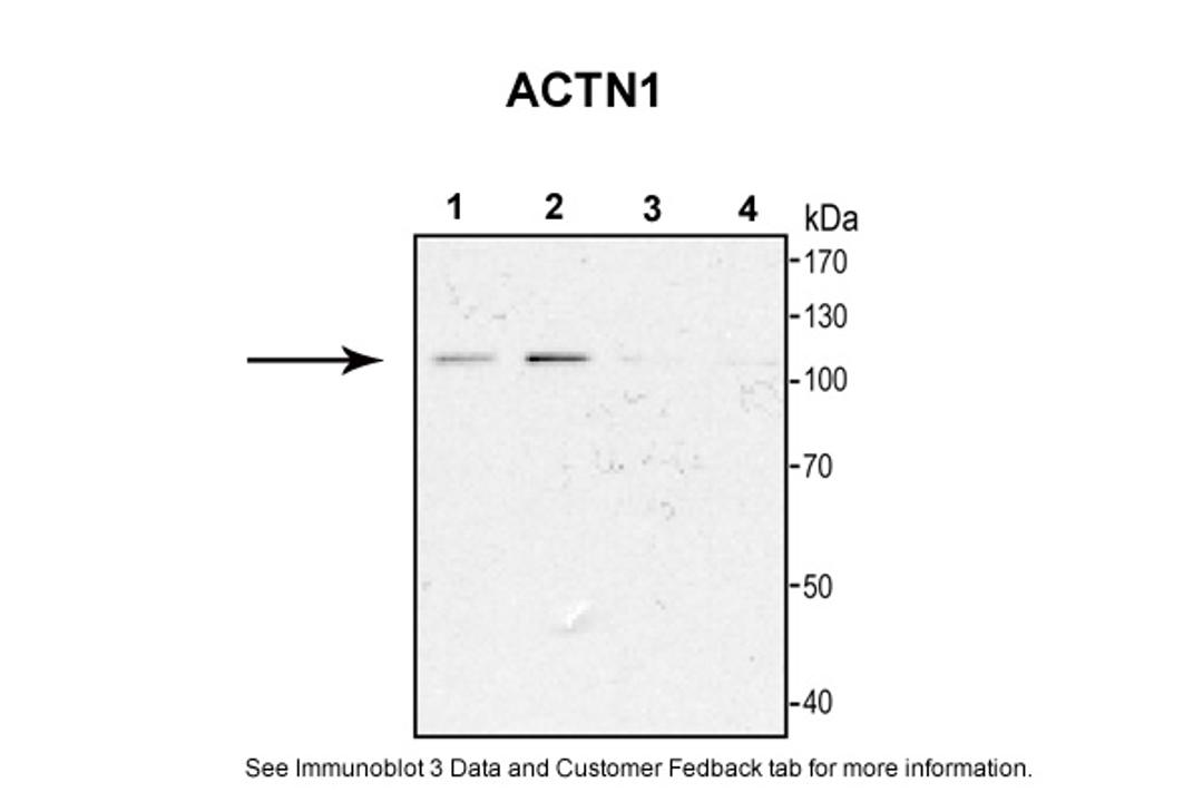 Antibody used in WB on Rat Cortical Neurons at 1:1000.