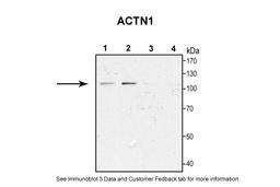 Antibody used in WB on Rat Cortical Neurons at 1:1000.