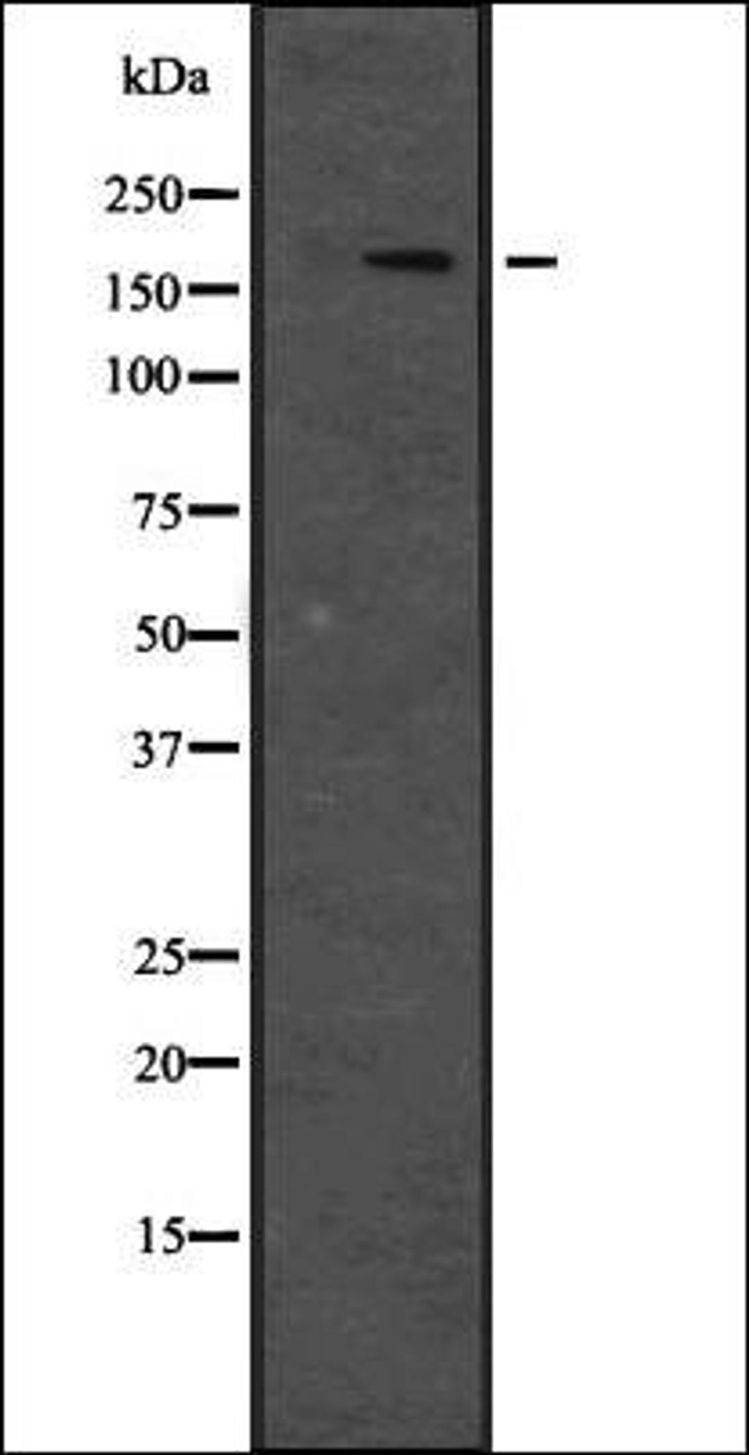 Western blot analysis of Hela cell lysate using JIP4 antibody