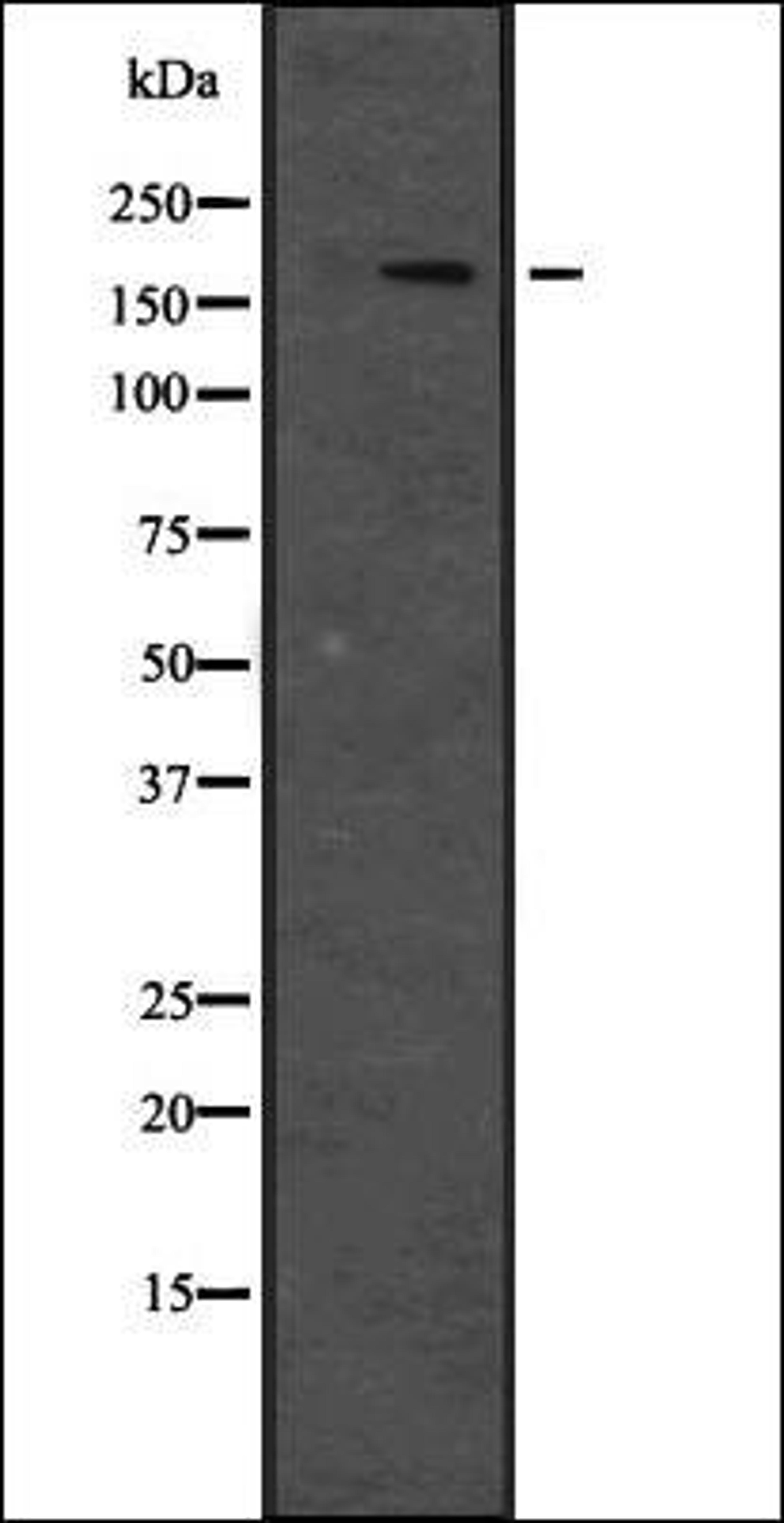 Western blot analysis of Hela cell lysate using JIP4 antibody