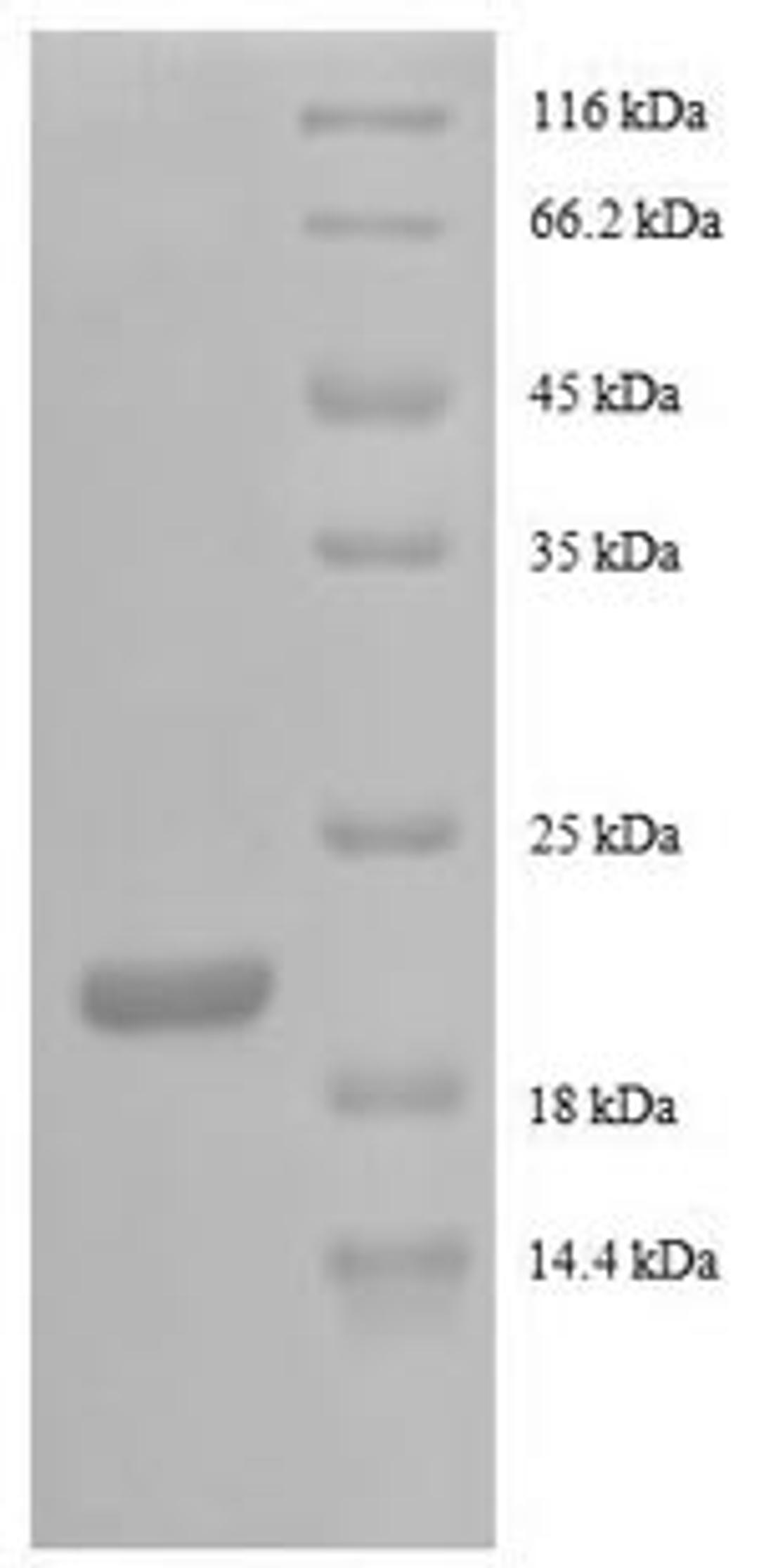 (Tris-Glycine gel) Discontinuous SDS-PAGE (reduced) with 5% enrichment gel and 15% separation gel.