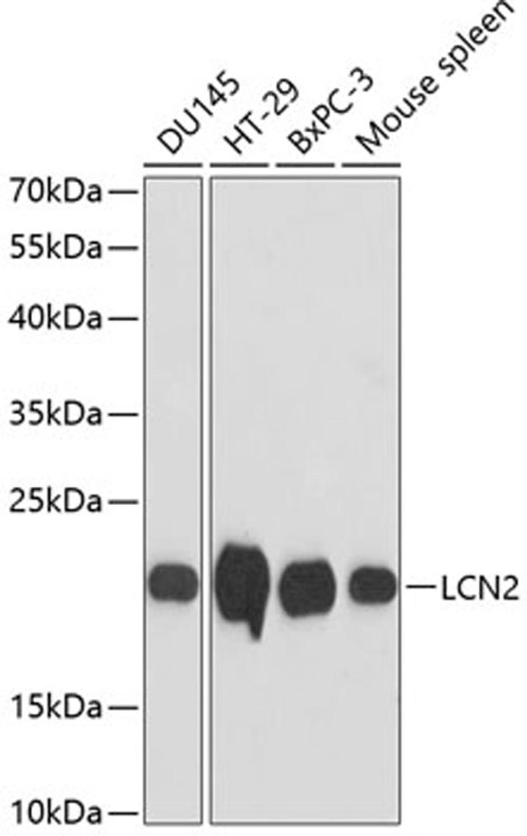 Western blot - LCN2 antibody (A2092)