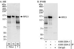 Detection of human RFC1 by western blot and immunoprecipitation.