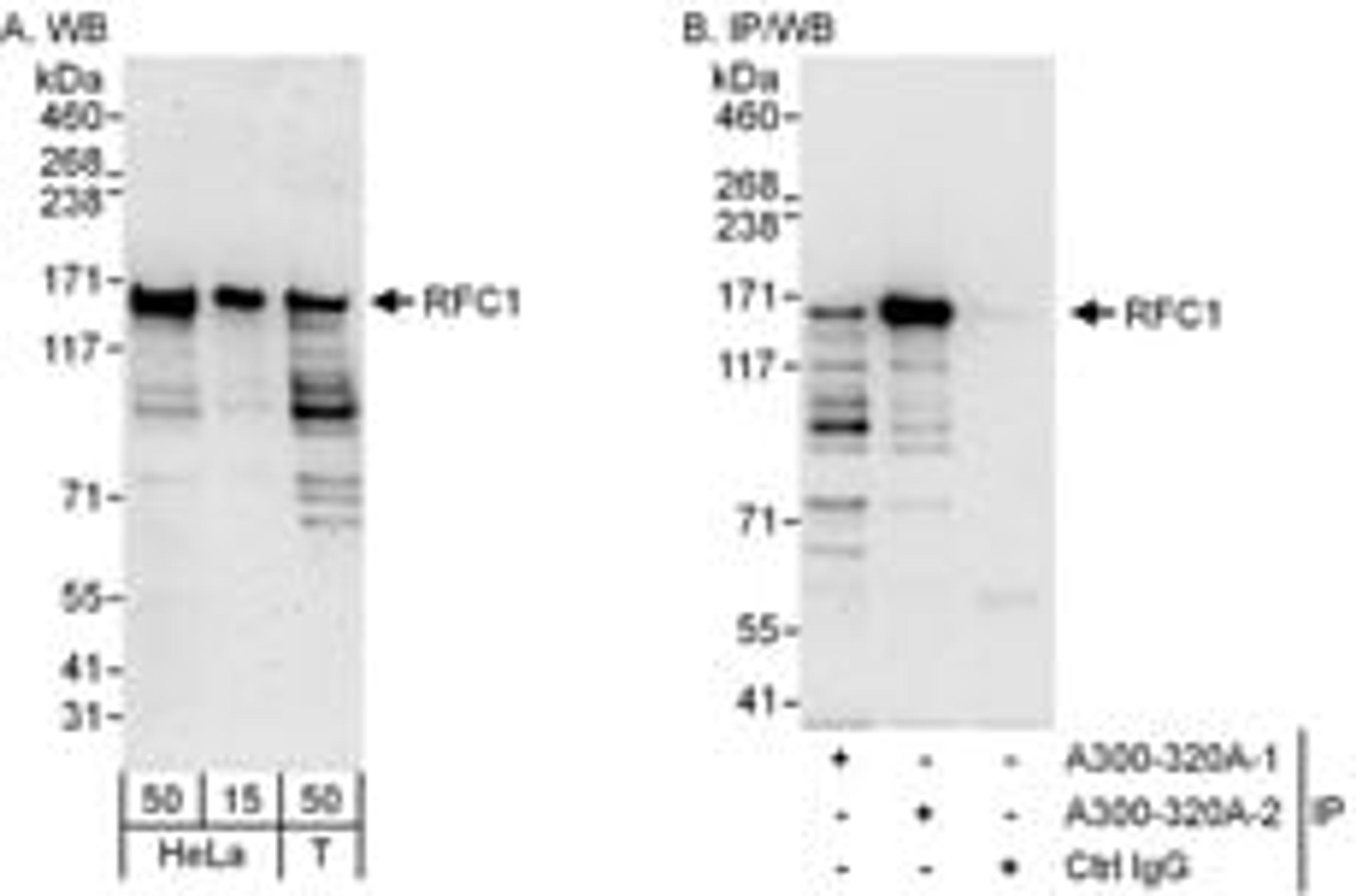 Detection of human RFC1 by western blot and immunoprecipitation.