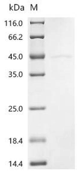 (Tris-Glycine gel) Discontinuous SDS-PAGE (reduced) with 5% enrichment gel and 15% separation gel.