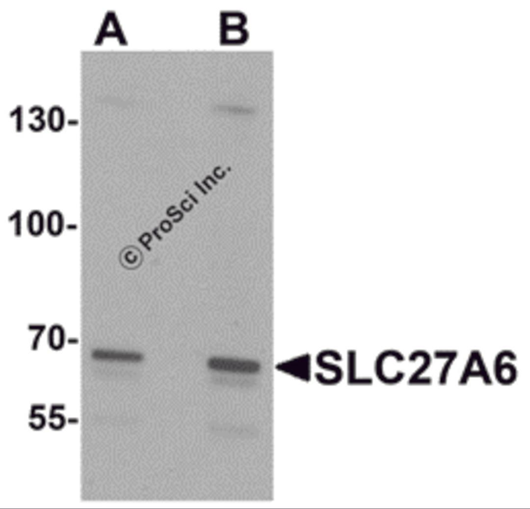 Western blot analysis of SLC27A6 in A20 cell lysate with SLC27A6 antibody at (A) 1 and (B) 2 &#956;g/mL.