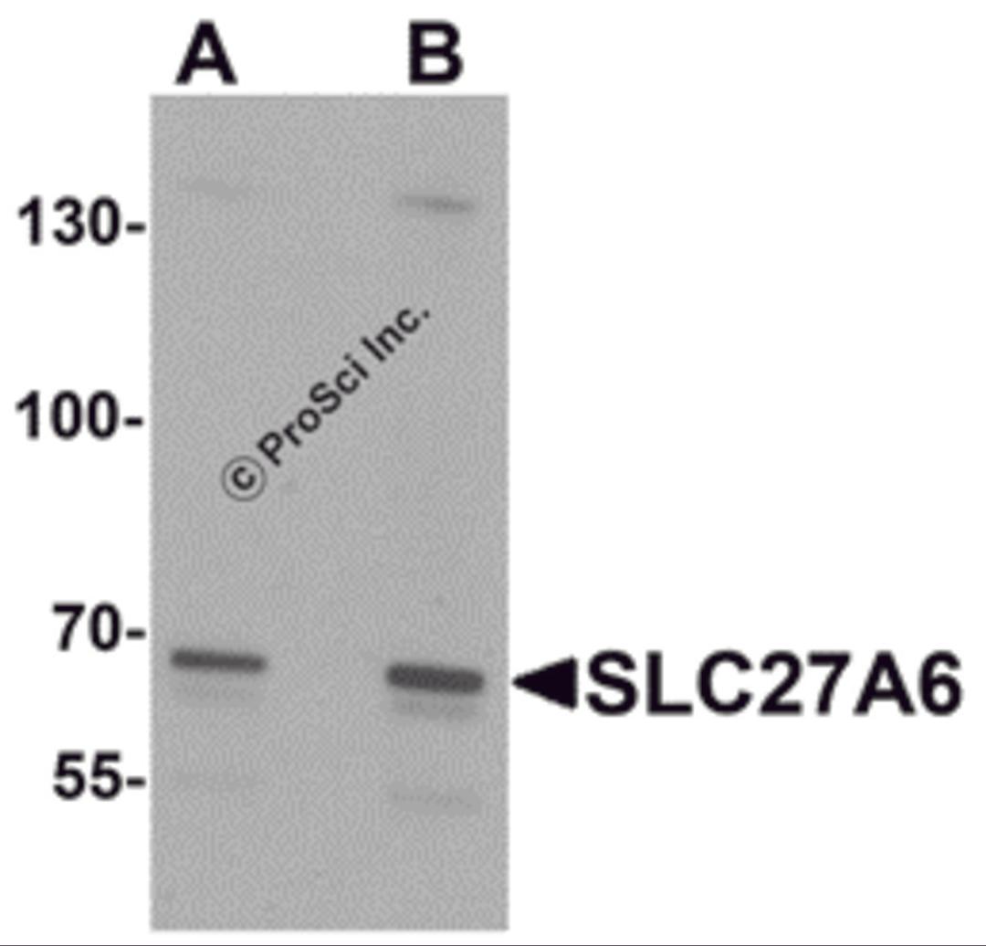 Western blot analysis of SLC27A6 in A20 cell lysate with SLC27A6 antibody at (A) 1 and (B) 2 μg/mL.