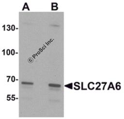 Western blot analysis of SLC27A6 in A20 cell lysate with SLC27A6 antibody at (A) 1 and (B) 2 μg/mL.