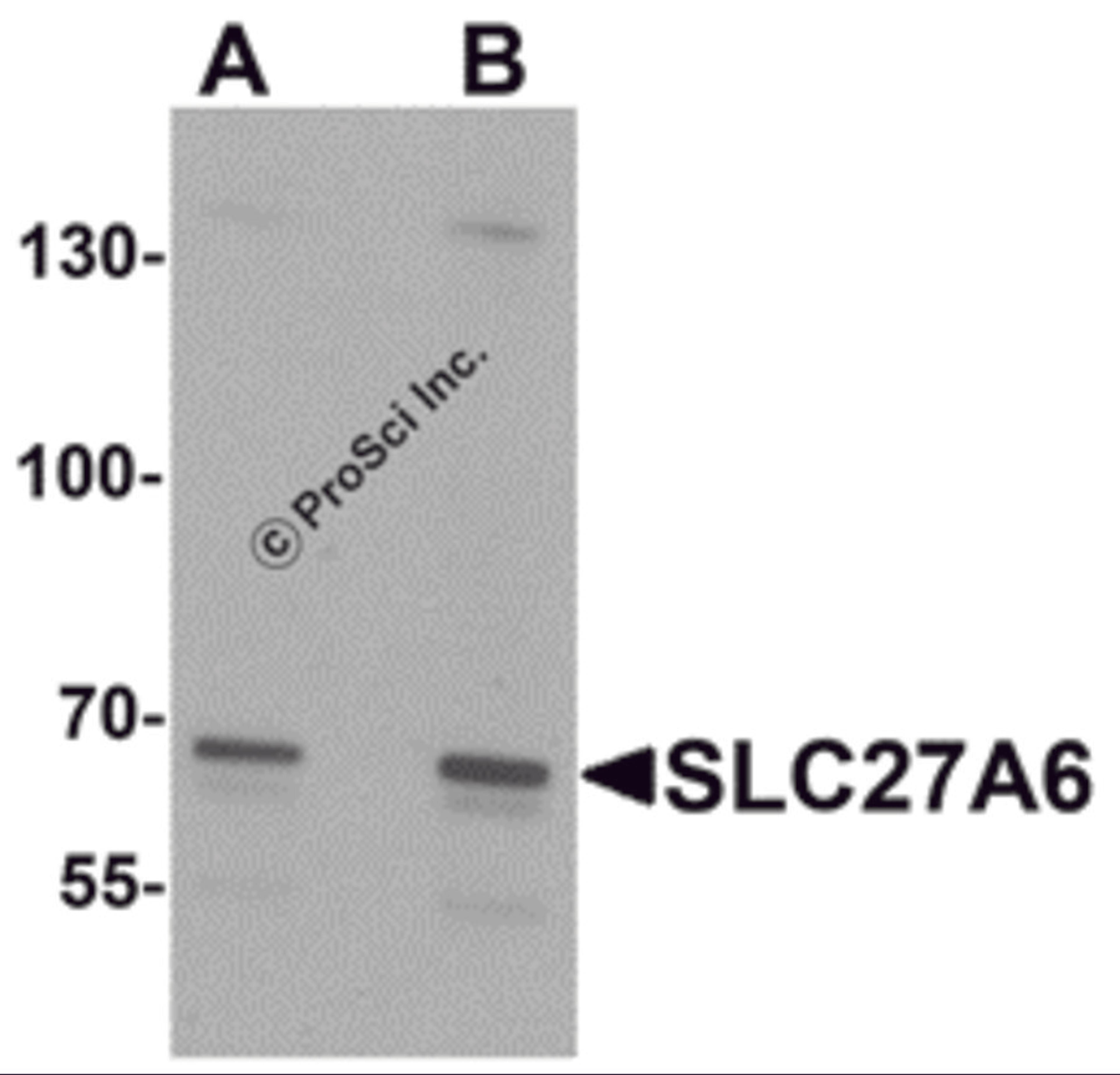 Western blot analysis of SLC27A6 in A20 cell lysate with SLC27A6 antibody at (A) 1 and (B) 2 μg/mL.