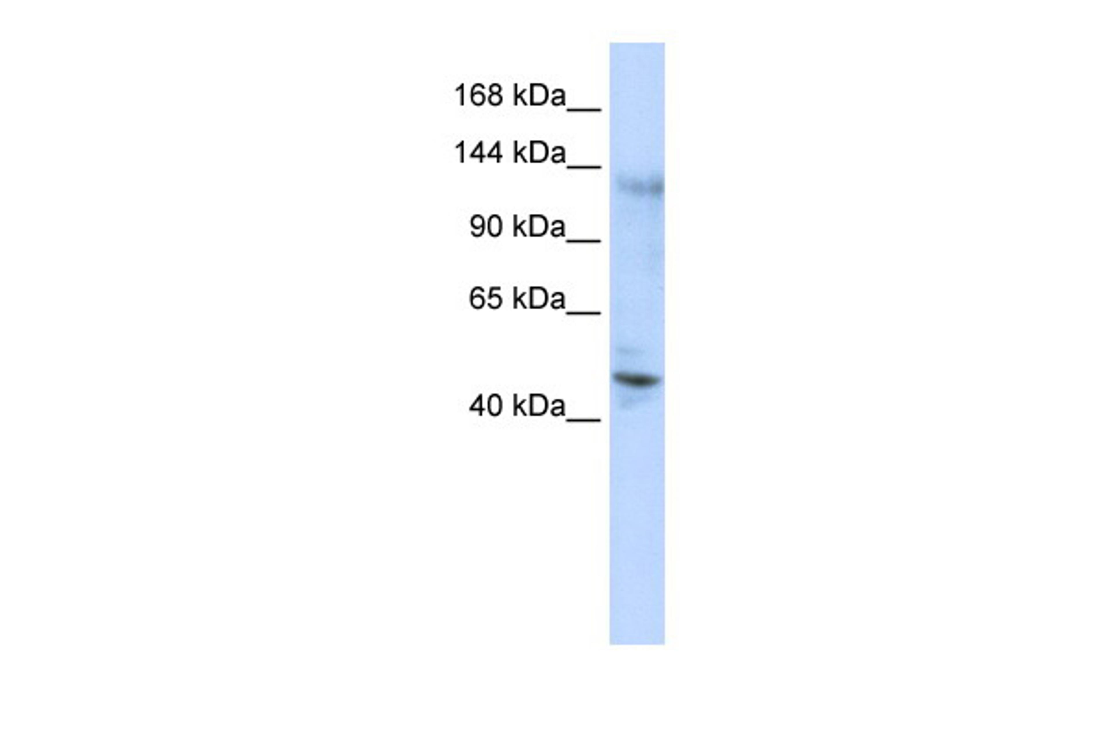 Antibody used in WB on Human 293T at 0.2-1 ug/ml.