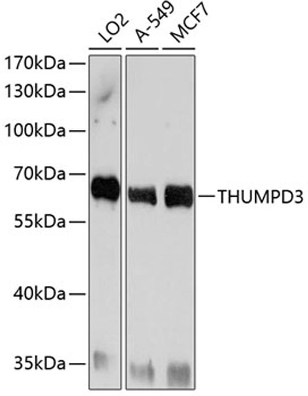 Western blot - THUMPD3 antibody (A10407)